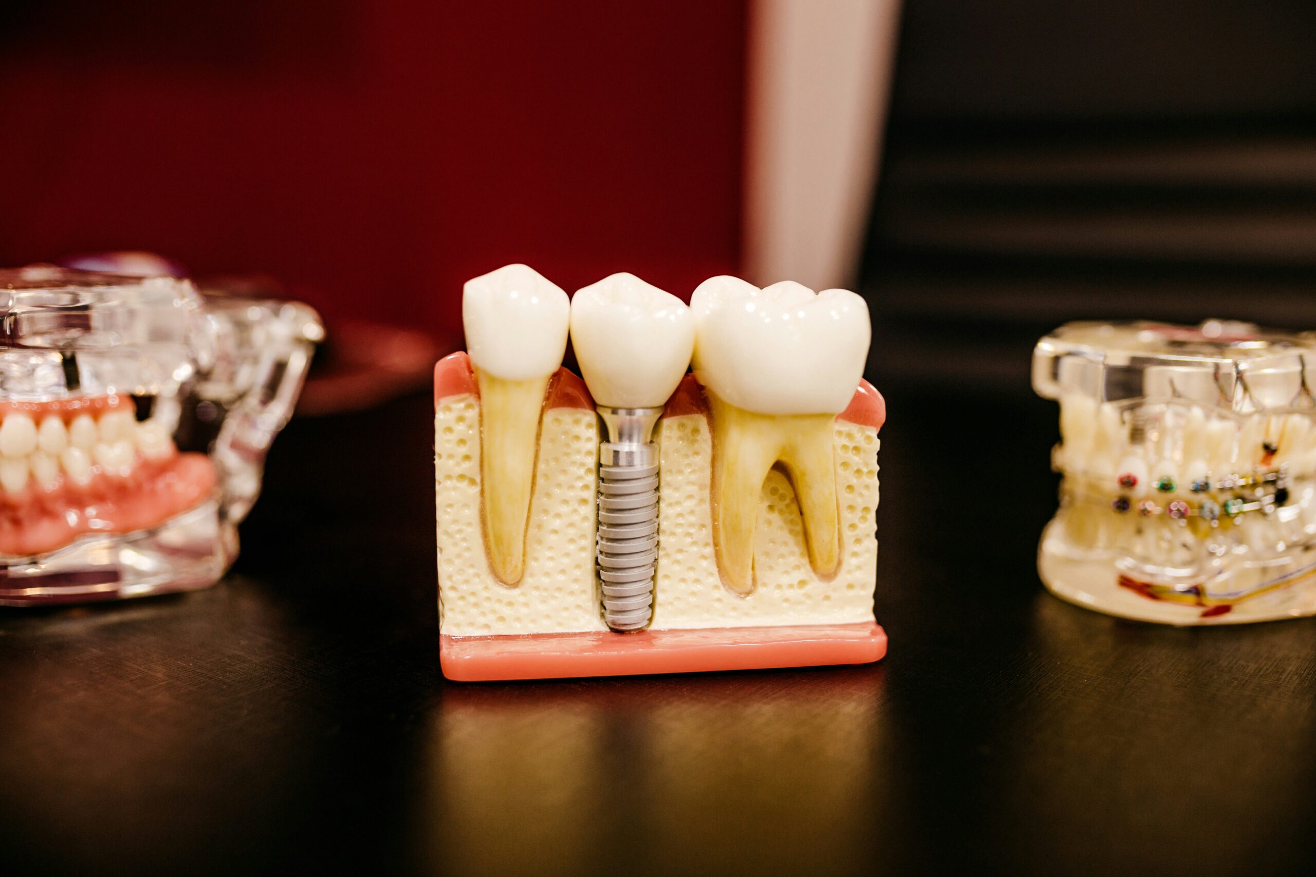 Dental implants showcased next to original teeth next to it